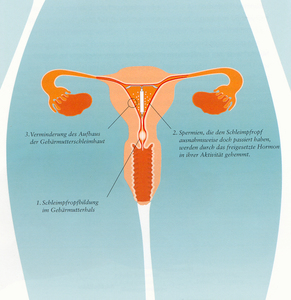 Schematische Darstellung der Wirkungsweise